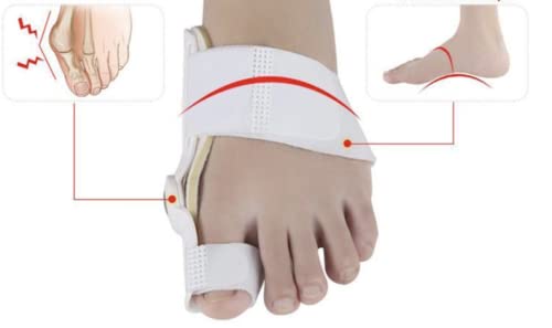 Khankah Sirajia Limited Hallux Valgus Big Toe Bunion Straightener Night Splint Pain Relief